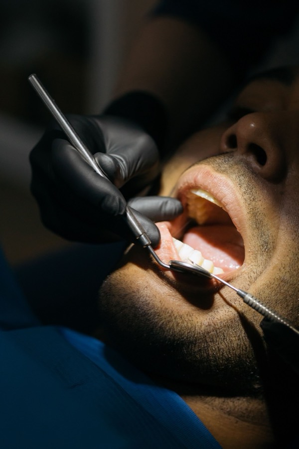 Close-up of a careful dental check-up at Care32